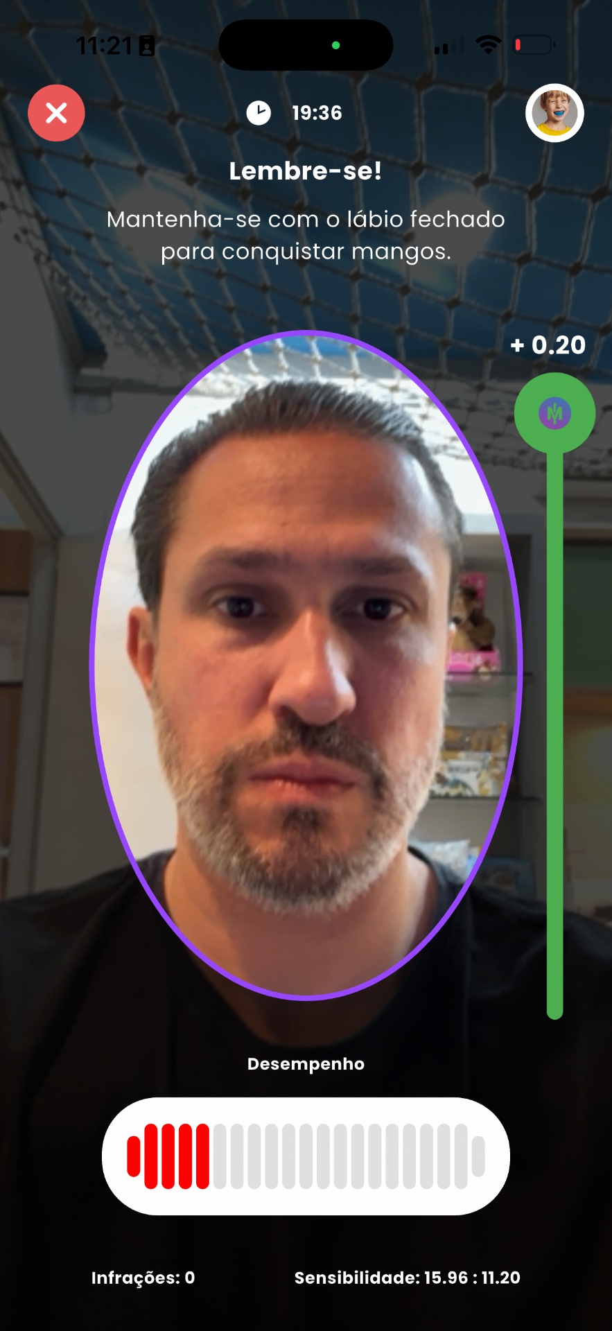Monitoramento de lábio fechado com gamificação no app Myoplay